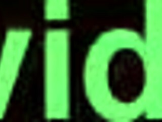 My unclean white female genitalia