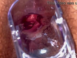 wow anal vision with speculum on mature bbw's hairy big ass 😈