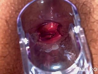 wow anal vision with speculum on mature bbw's hairy big ass 😈