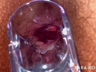 wow anal vision with speculum on mature bbw's hairy big ass 😈