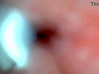 Endoscope spies hot male cum explosion inside?