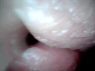 Endoscope spies hot male cum explosion inside?