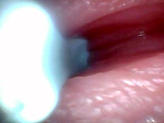 Endoscope spies hot male cum explosion inside?